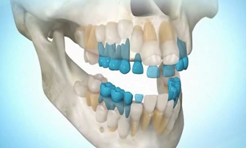Картинка к материалу: «Попрощайтесь с зубными имплантатами, Вы можете вырастить собственные зубы за 9 недель!»
